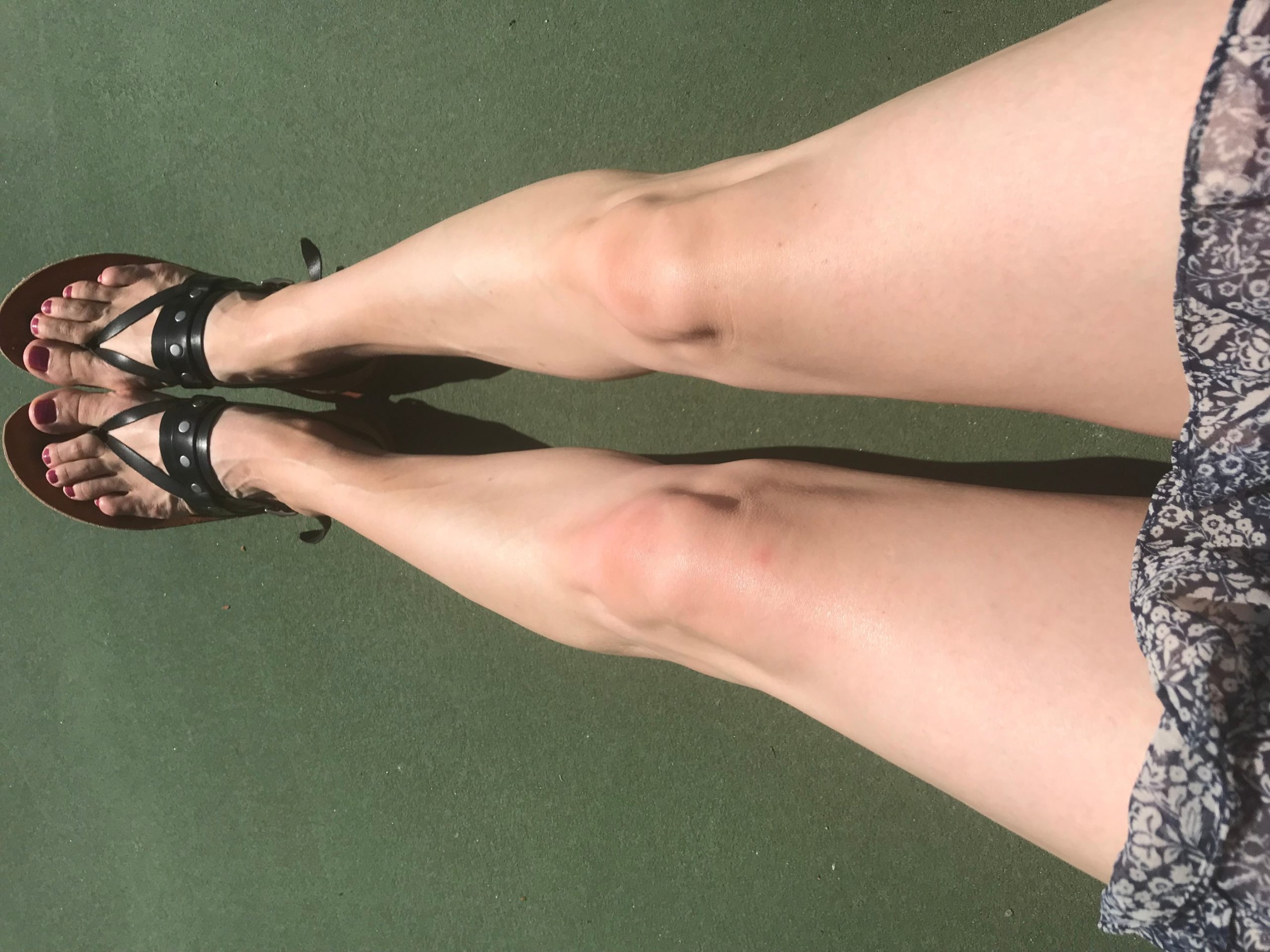 legs-sm